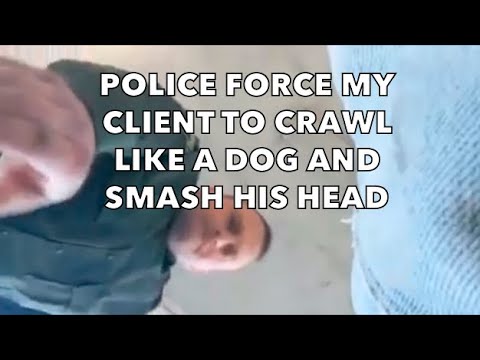 Police Force My Client to Crawl Like a Dog and Bust His Head Open - New Video