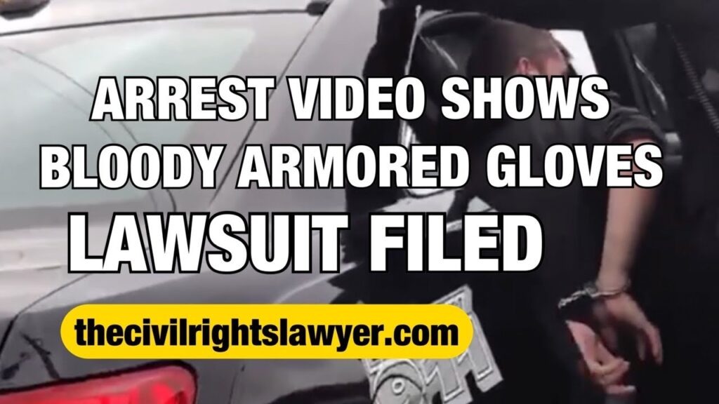 Arrest Video Shows Bloody Armored Gloves - LAWSUIT filed today