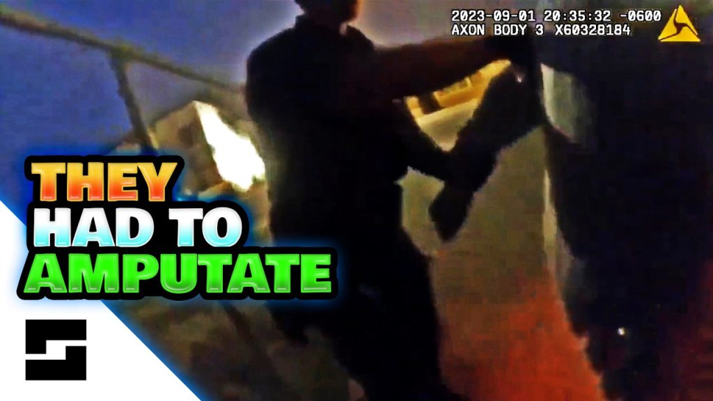 Cops Throw Woman - They Amputated Her Leg