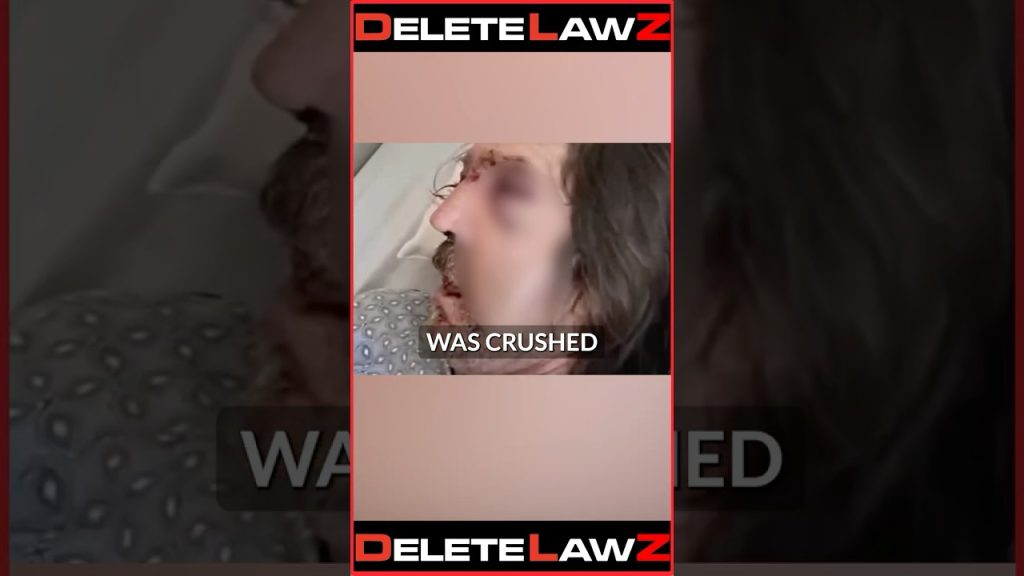 COPS B**T MAN DOWN AND TAKE PICTURES OF HIS INJURIES!