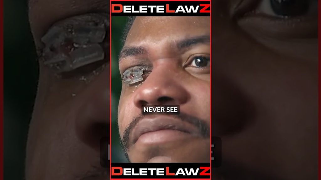 COP T*SES MAN IN THE EYE BLINDING HIM FOR LIFE!