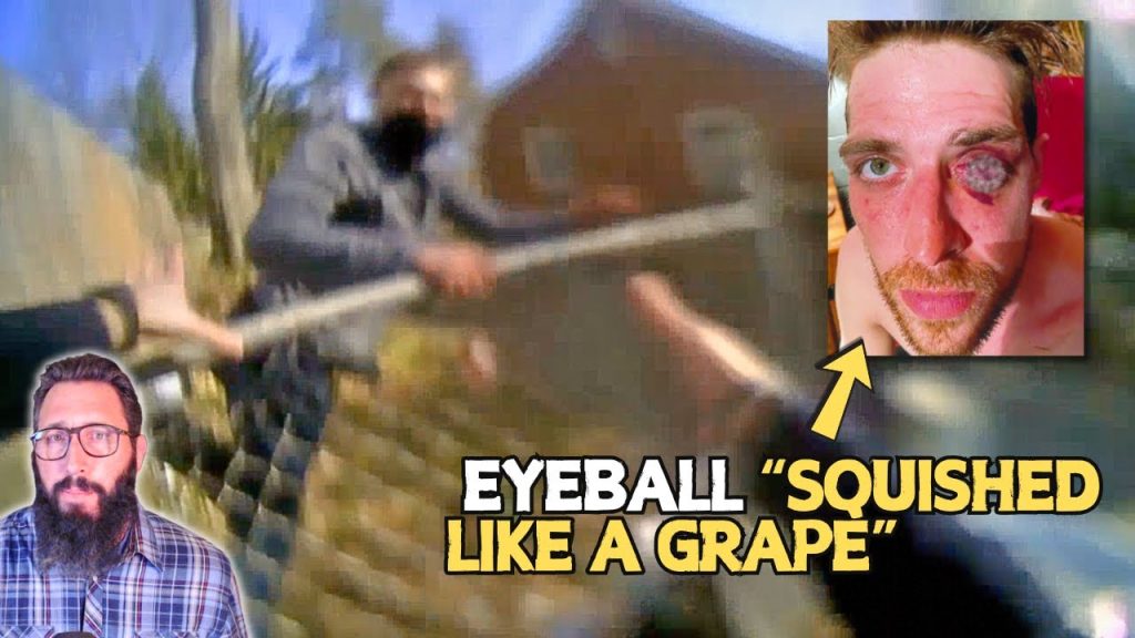 Cop Costs Taxpayers $4 Million for Blinding Innocent Man, Gets Promoted