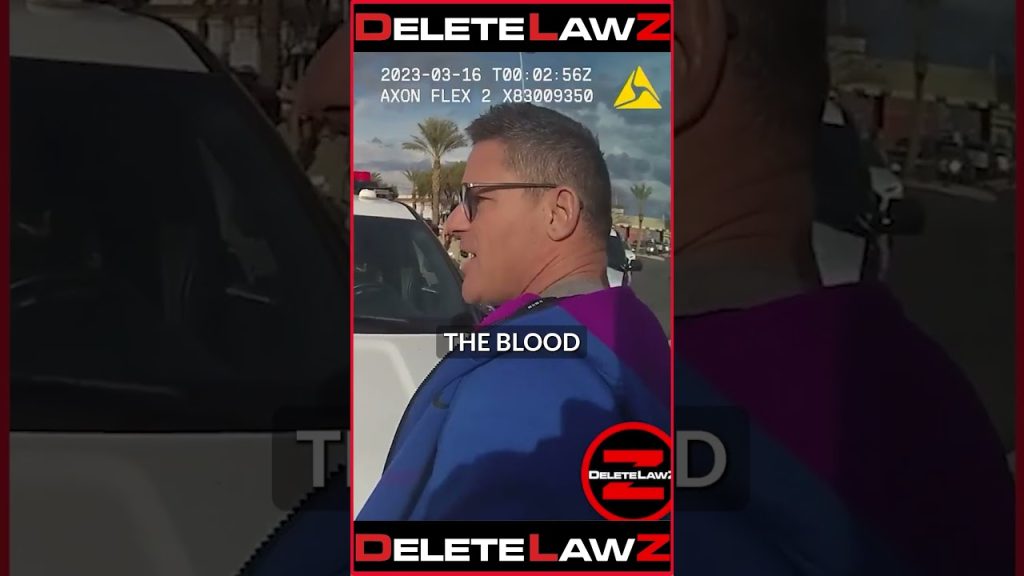 DIRTY COP DAMAGES MY UNLAR NERVE AFTER ARRESTING ME!